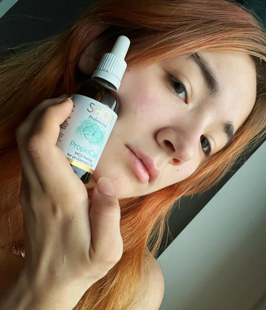 MGS Peeling for problematic skin
